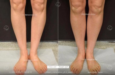 “Plastik, estetik və rekonstruktiv cərrahiyyədə müasir yanaşmanın simvolu – PhD Dr. Dilqəm Məhərrəmov” “Plastik, estetik və rekonstruktiv cərrahiyyədə müasir yanaşmanın simvolu – PhD Dr. Dilqəm Məhərrəmov”