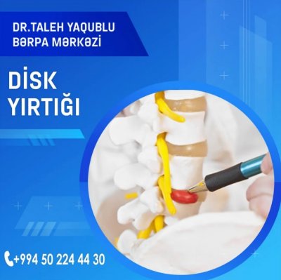 Peşəkar Vertebroloq Dr. Taleh Yaqublu – Sizin Sağlam Onurğanızın Qarantı Peşəkar Vertebroloq Dr. Taleh Yaqublu – Sizin Sağlam Onurğanızın Qarantı